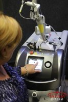 Laser tattoo removal machine