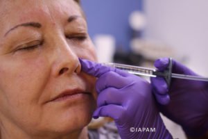 Female patient getting facial injection