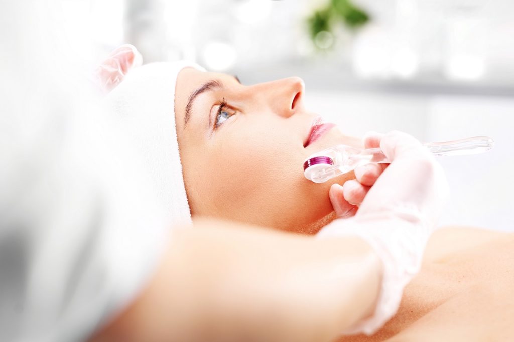 female patient receiving microneedling treatment