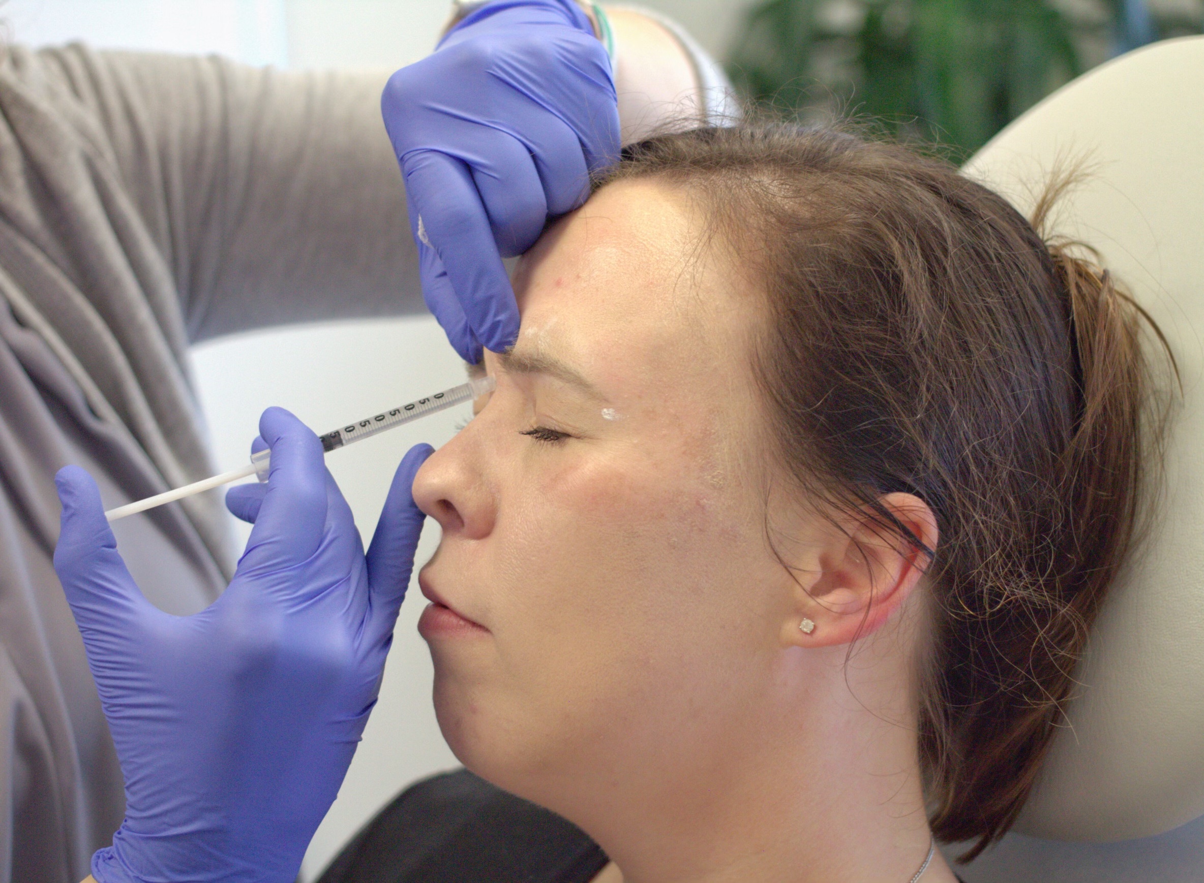 Patient getting elevens botox injection