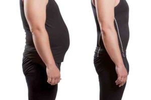 lipo shots weight loss