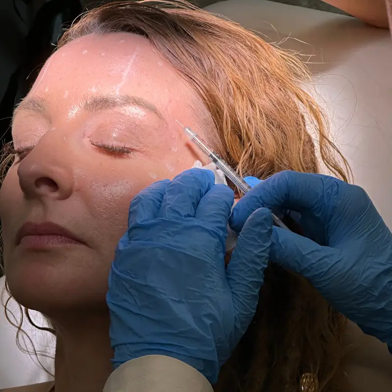 Concierge Botox Business patient getting facial injections