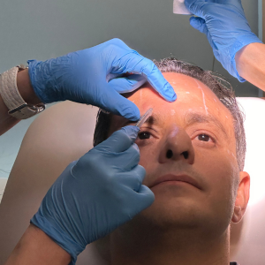 Image of man receiving Boto injection at the IAPAM's Aesthetic Medicine Symposium