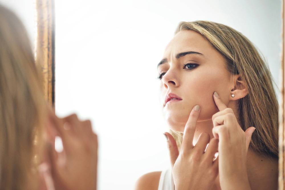 Cyst vs. Pimple