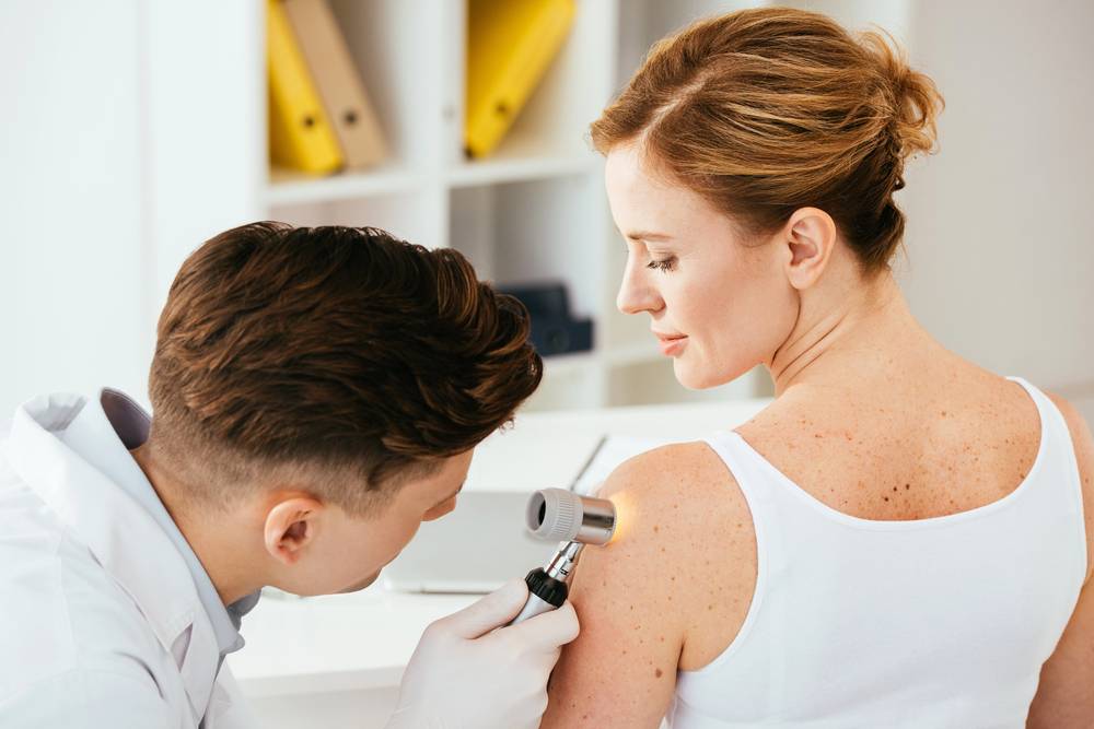 Sun Spots vs. Melanoma