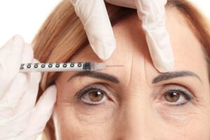 Botox Results for the Forehead
