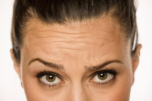 Forehead Botox® Dosing Guide for Beginners
