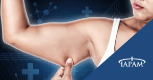 Body Contouring For GLP-1 Patients: Evaluating Ultherapy PRIME