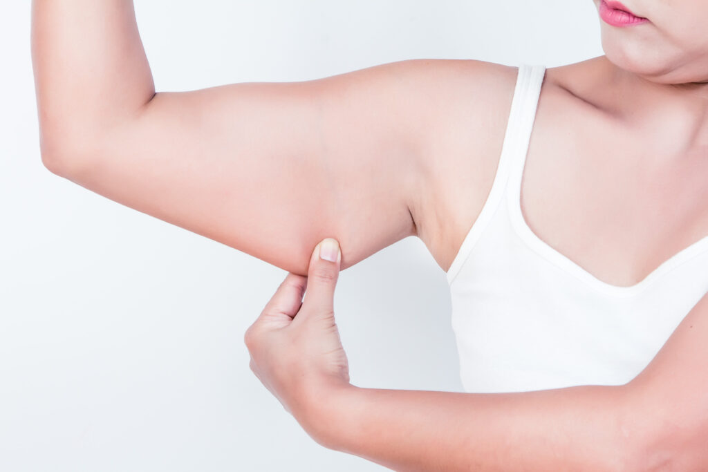 Loose skin under arms
