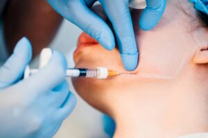 Masseter Botox