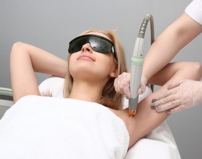 laser hair removal on female patient